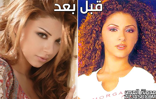 صور الفنانات العرب قبل وبعد عمليات التجميل 8