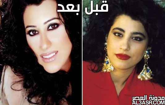 صور الفنانات العرب قبل وبعد عمليات التجميل 3