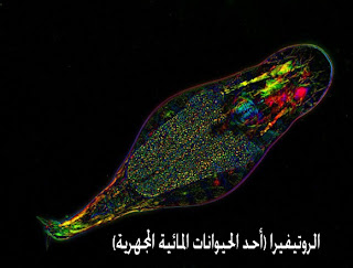 صور غريبة 880_Michael%252BShribak_VEPS_Rotifer-580x441