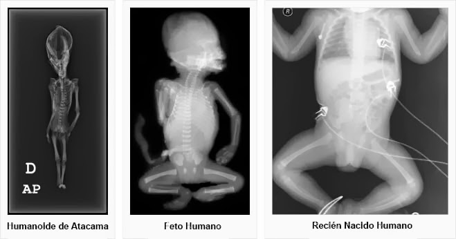 Humanoide de Atacama. Comparacion-del-extraterrestre-de-Atacama