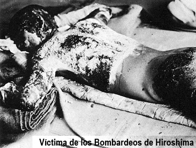 lineas de tiempo - ¿Profetizó Parra en dos lineas de tiempo? - Página 2 790px-victim_of_atomic_bomb