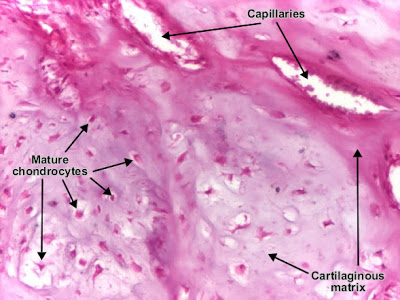 مكتبة الصور الطبية : - باثولوجى -- Pathology slides Chondroma_detail