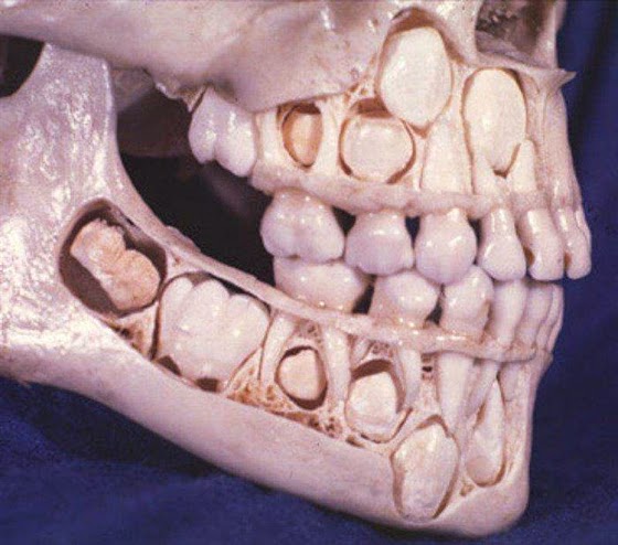 مجموعة صور حقيقية لا تصدق أقرب الى الخيال Baby-teeth