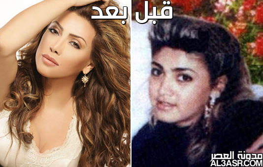 صور الفنانات العرب قبل وبعد عمليات التجميل 9