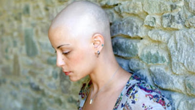 Η απώλεια μαλλιών στη χημειοθεραπεία, μπορεί να καταπολεμηθεί!  Woman_no_hair