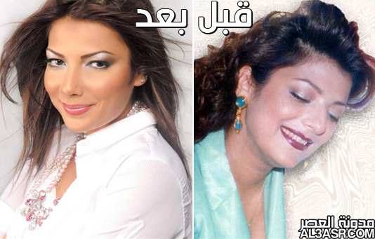 صور الفنانات العرب قبل وبعد عمليات التجميل 2