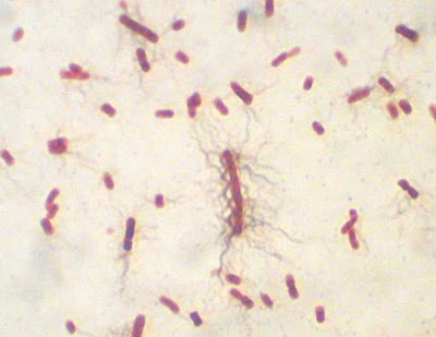 صور بكتيريا - Bacteria slides Proteus_vulgaris_flagella_best_P7311252