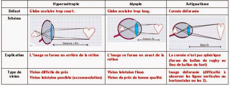 November's Girl and roses - Page 13 Tableau%2Bd%C3%A9faut%2Bvision%2Bforme%2Boeil