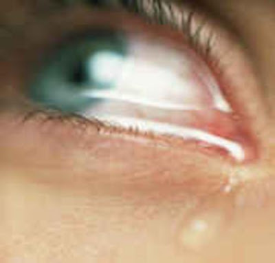 Foto Sy te perlotur - Faqe 3 Eye-crying