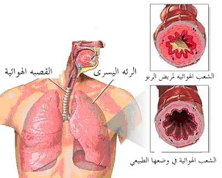 الربو ( حساسية الصدر ) Image021