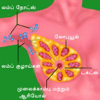 மார்பகப் புற்றுநோய் பற்றி விவரங்கள் - LymphaticsLab