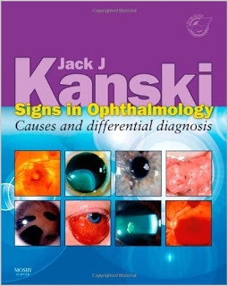 Signs in Ophthalmology: Causes and Differential Diagnosis: Expert Consult - 2010 Edition OPHTHALMOLOGY
