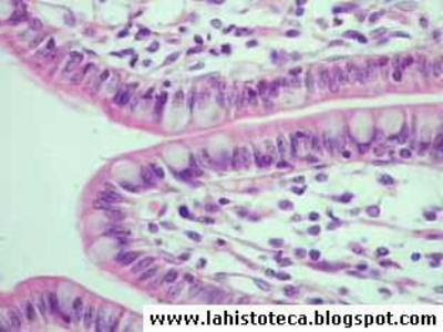 quizz histologia!!!! Intestino%2Bdelgado%236