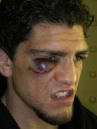 Just like this pic and wanted to post it somewhere part 1 - Page 11 Nick-diaz