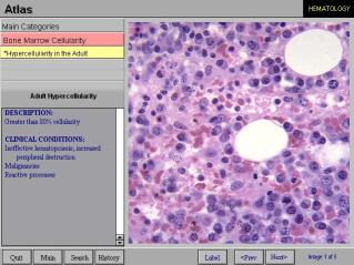 Interactive atlas of Hematology 26762.imgcache