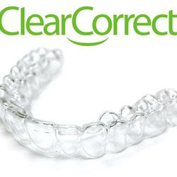 Giới thiệu về niềng răng Clear Aligner Gioi-thieu-nieng-rang-clear