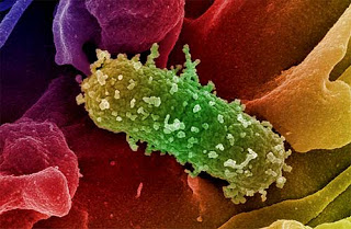 Il superbatterio E. Coli è stato ingegnerizzato per provocare decessi. Le prove  E.coli-O157