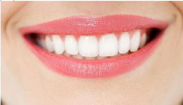 Tìm hiểu quy trình bọc răng sứ thẩm mỹ Boc-rang-su-tham-my-11