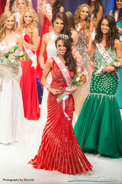 Chanel Beckenlehner was crowned Miss Universe Canada 2014 Univcanada