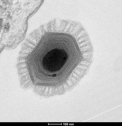 Descubrimiento de un virus gigante desafía la ciencia Megavirus