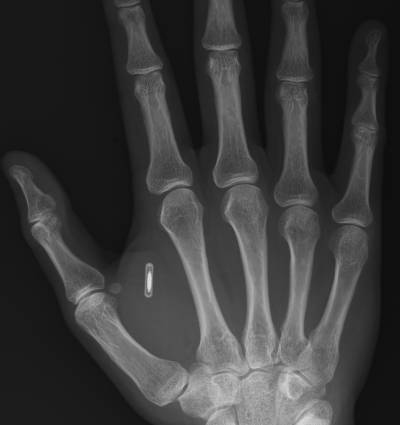 Σφράγισμα - 666 - Σελίδα 27 Rfid_in_hand