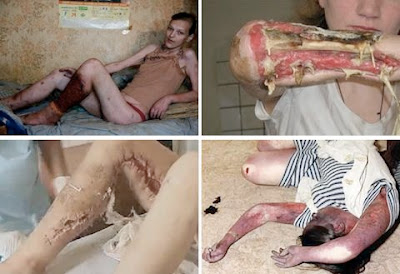 [OFF-Topic] KROKODIL:A droga zumbi russa que faz viciados Apodrecerem  Waxw