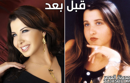 صور الفنانات العرب قبل وبعد عمليات التجميل 4