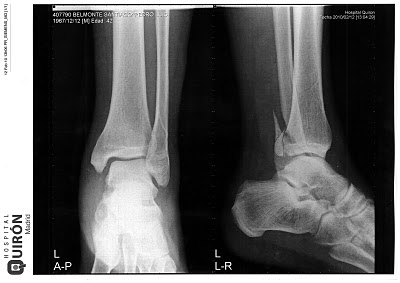 El despiadado Rattlesnake. RADIOGRAFIA