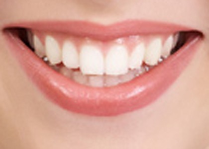 ددان لة خةوندا ماناى جيه White-Teeth-1