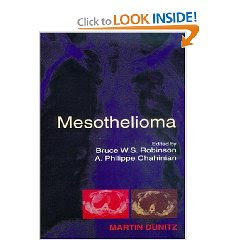 Mesothelioma 5