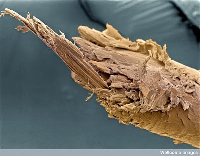 Beautiful Microscopic Images from Inside the Human Body 2370529110104178106S600x600Q85