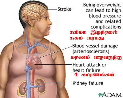 சும்மா இருக்கச் சுகம் வராது! மரணம் வரும்  Obesity-and-health