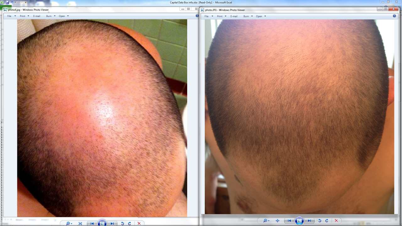 1.5 year pics: buzzed hair vs buzzed hair Tumblr_mp9ez0e6Xp1speilco1_1280