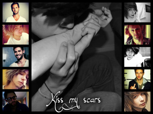 Kiss my Scars. Tumblr_mg8hv9AME71r4edi6o1_500