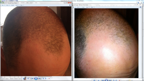 1.5 year pics: buzzed hair vs buzzed hair Tumblr_mp9fsntipn1speilco1_500
