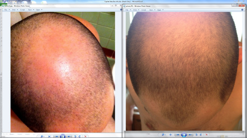 1.5 year pics: buzzed hair vs buzzed hair Tumblr_mp9ez0e6Xp1speilco1_500