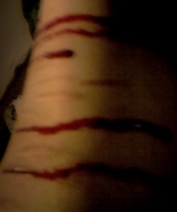 صور يد مجروحة  Tumblr_mbn1fzfPuc1rqfceco2_250
