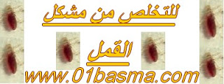 لإزالة القمل من الشعر Basma