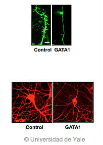 El estrés y la depresión pueden encoger el cerebro Gata1