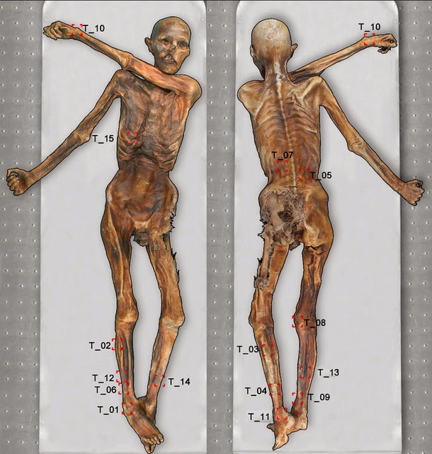 Ötzi, el «hombre de hielo», sufría del corazón y tiene «parientes» vivos Momia-hielo2