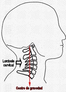 Z-01 - JUEGO SIGUE LA IMAGEN  - Página 69 Rectificaci%C3%B3n-de-la-lordosis-cervical