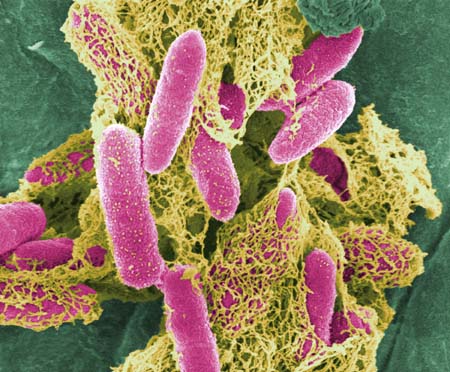 Dois casos suspeitos de E.coli em Campinas (SP) estão em investigação E_coli