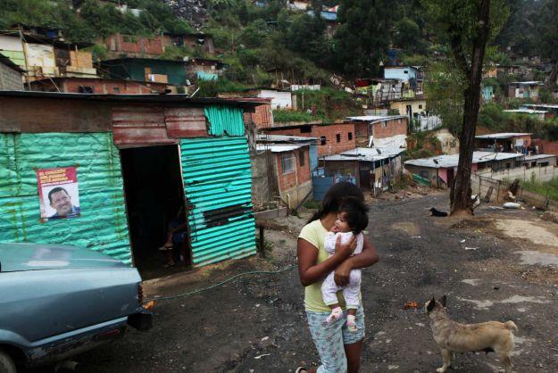 Chávez : a veces la gente olvida que soy un ser humano ( explica cómo se cagó) CHAVEZ