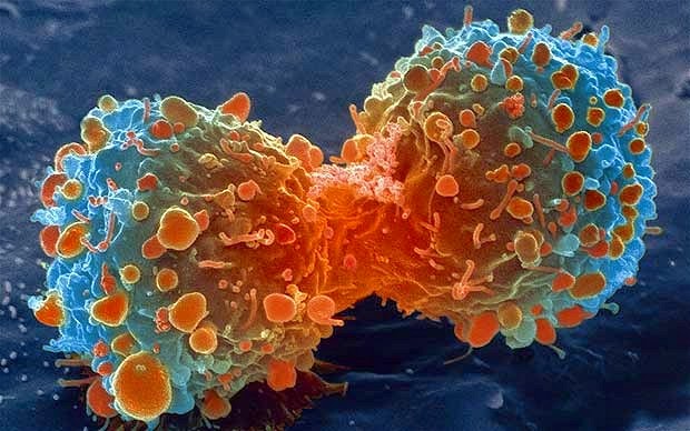 اضرار قلة النوم و النوم في أوقات متأخرة Cancer-lambert_2469736b