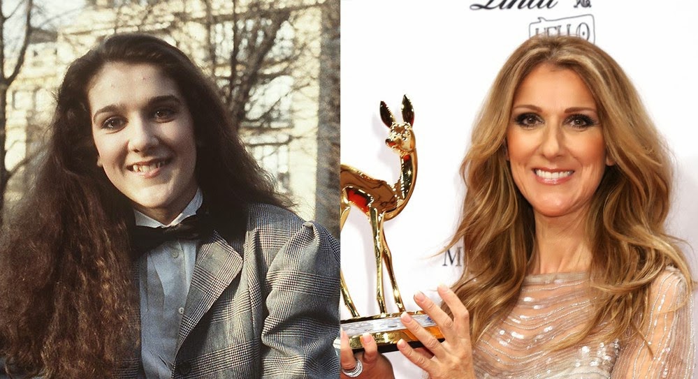 Pictures -  latest 2014 Celine Dion husband and kids Pictures and when she was young, life career pics Celine-dion-avant-apres-chirurgie-16627_w1000