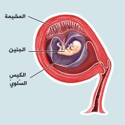 أسباب نقص ماء الجنين Two-month