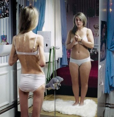 Ana & Mía: La Triste Realidad detrás de estas "Princesas" Anorexia%5B1%5D