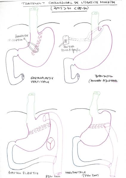 Chirurgie digestive Cours & Illustrations Chirurgie