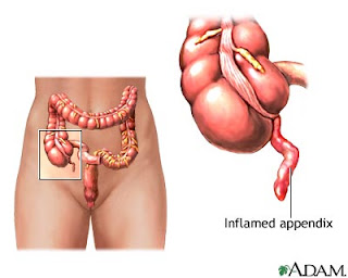 livre Hépato-Gastro-Entérologie by admin Appendice