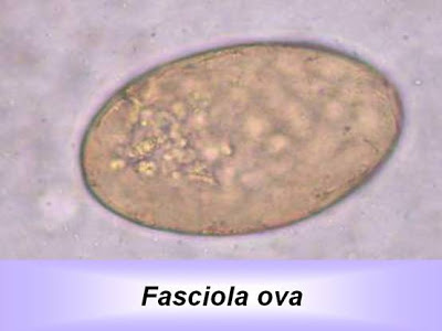 اطلس الطفيليات -1- Fasciola